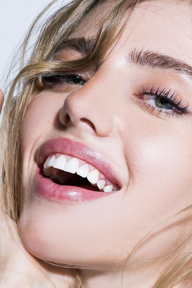 veneers and implants